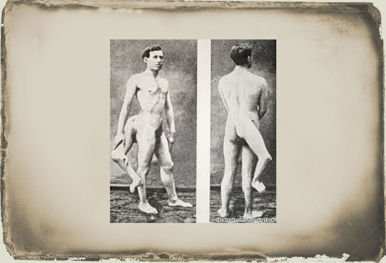Anatomy frank lentini